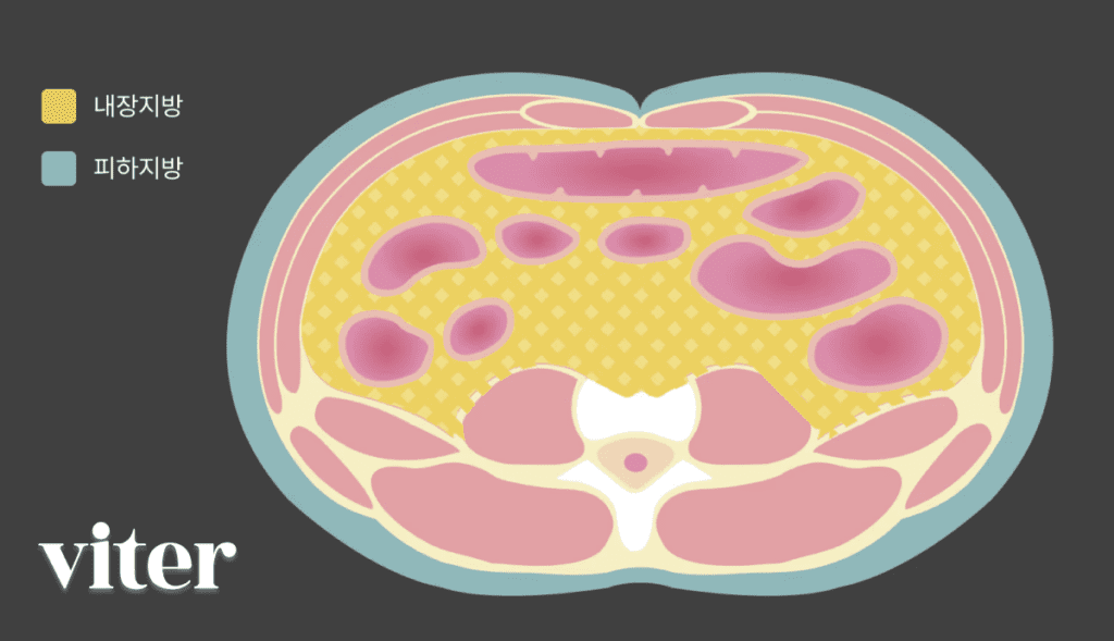 내장지방과 피하지방 차이