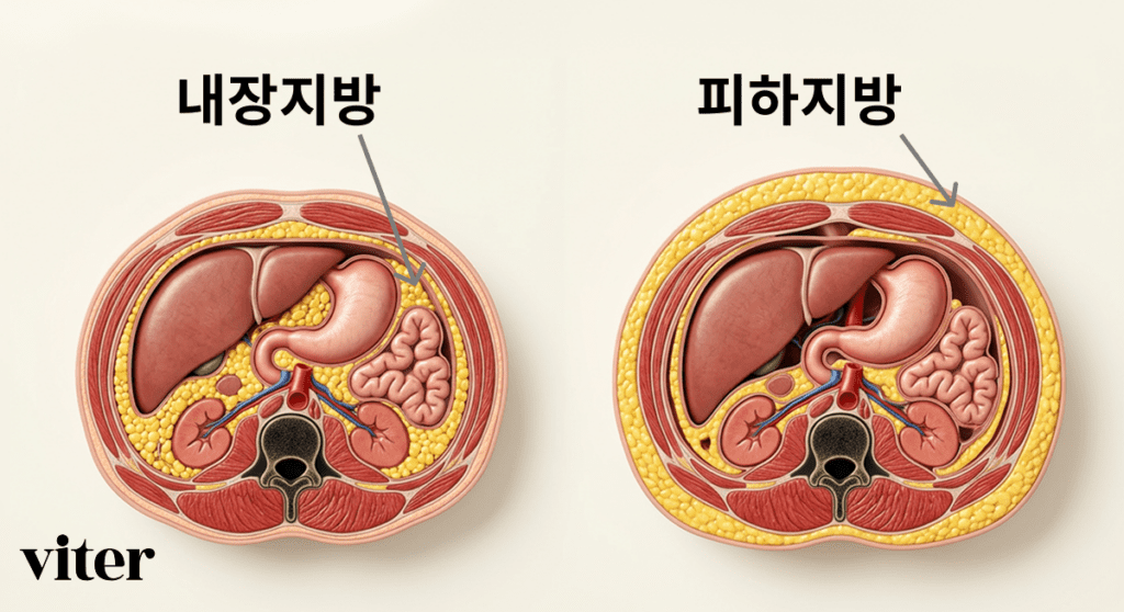 내장지방과 피하지방 차이