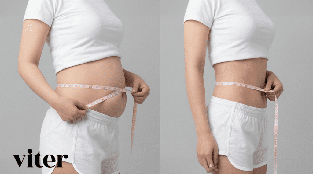 복부 허리 둘레를 줄이는 지방분해주사 전후 측면 비교