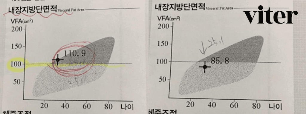 내장지방단면적 수치가 감소하여 스탭퍼 다이어트 효과를 보여주는 그래프