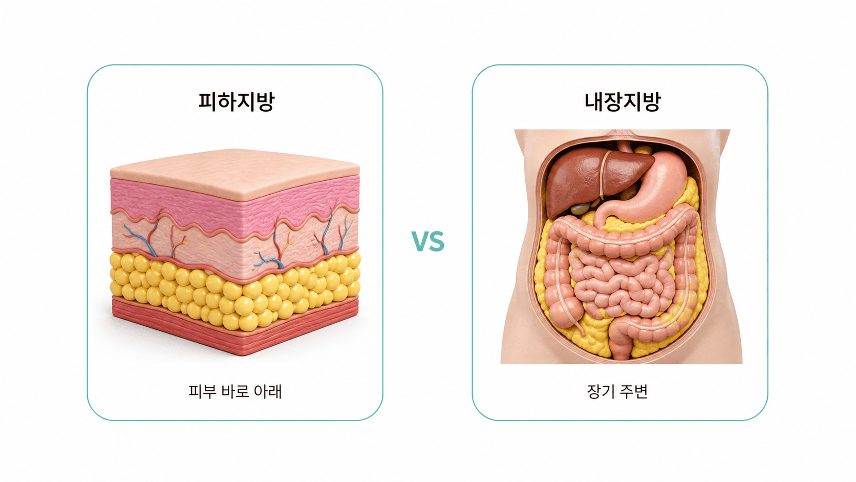 피하지방은 피부 바로 아래, 내장지방은 장기 주변에 있는 해부학적 위치.